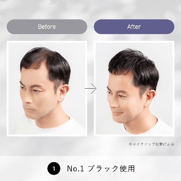 スーパーミリオンヘアー コンパクトセット 10g+15ml SUPER MILLION