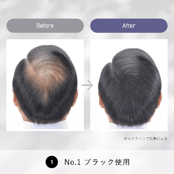 【２０個セット】 ルアン スーパーミリオンヘアー コンパクトセット No.1 ブラック(10g+15ml)×２０個セット【s】 スーパーミリオンヘアー コンパクトセット 10g+15ml SUPER MILLION